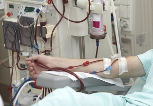 Em estágios avançados da insuficiência renal crônica, o tratamento com hemodiálise pode ser necessário