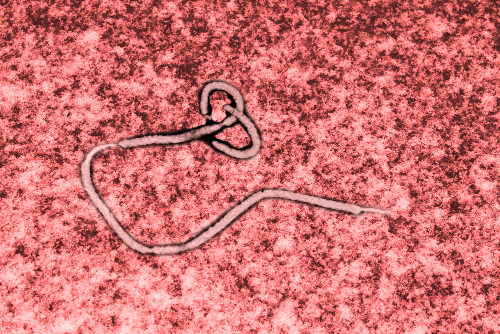 O ebola é um exemplo de vírus e caracteriza-se por sua agressividade, causando a morte de grande parte dos acometidos.