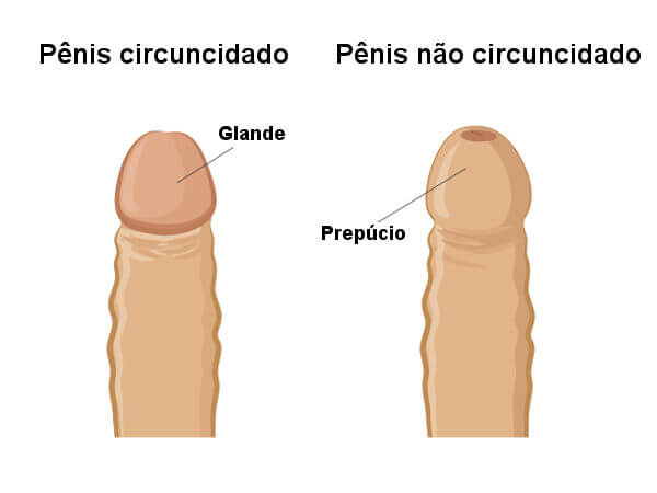 Ilustração de como é o pênis após a circuncisão.